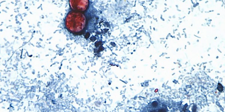US-Behörden untersuchen neuen Parasitenausbruch mit 72 Erkrankten